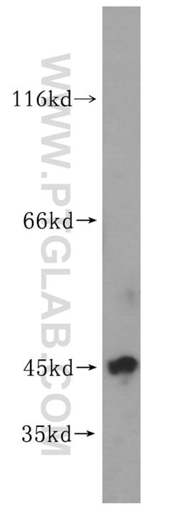 UBE2Z Rabbit anti-Human, Mouse, Rat, Polyclonal, Proteintech 150 &mu;L;