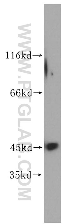 UBE2Z Rabbit anti-Human, Mouse, Rat, Polyclonal, Proteintech 150 &mu;L;