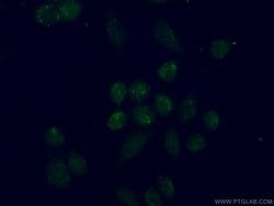 TBX2 Rabbit anti-Human, Mouse, Rat, Polyclonal, Proteintech 150 &mu;L;