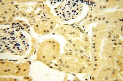 TBX2 Rabbit anti-Human, Mouse, Rat, Polyclonal, Proteintech 150 &mu;L;
