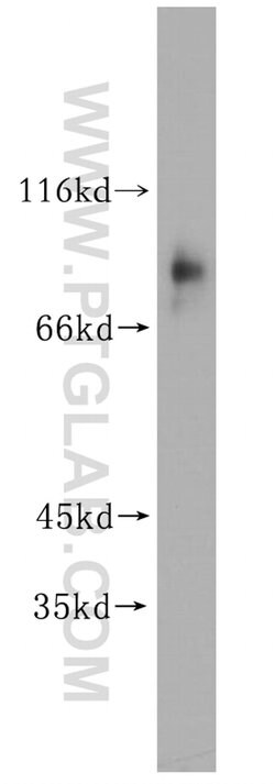 TBX2 Rabbit anti-Human, Mouse, Rat, Polyclonal, Proteintech 150 &mu;L;