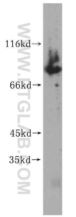 TBX2 Rabbit anti-Human, Mouse, Rat, Polyclonal, Proteintech 150 &mu;L;