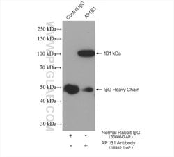 AP1B1 Rabbit anti-Human, Mouse, Rat, Polyclonal, Proteintech:Antibodies:Primary