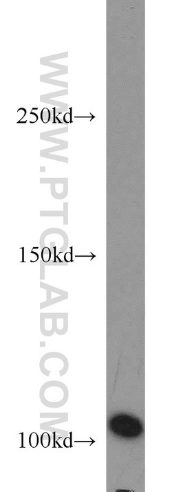 AP1B1 Rabbit anti-Human, Mouse, Rat, Polyclonal, Proteintech:Antibodies:Primary