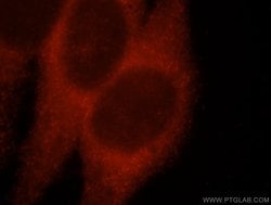 AP1B1 Rabbit anti-Human, Mouse, Rat, Polyclonal, Proteintech:Antibodies:Primary