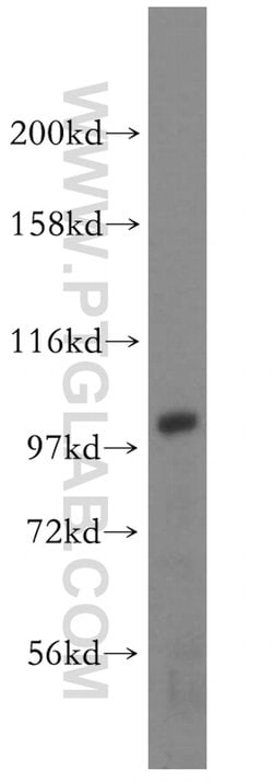 AP1B1 Rabbit anti-Human, Mouse, Rat, Polyclonal, Proteintech:Antibodies:Primary