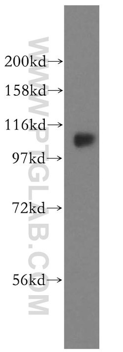 FAM29A Rabbit anti-Human, Polyclonal, Proteintech 150 &mu;L; Unconjugated:Antibodies,