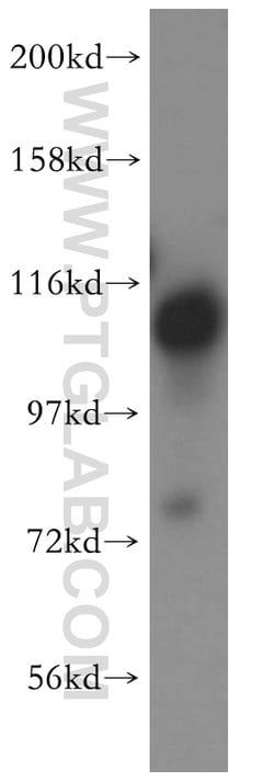 FAM29A Rabbit anti-Human, Polyclonal, Proteintech 150 &mu;L; Unconjugated:Antibodies,