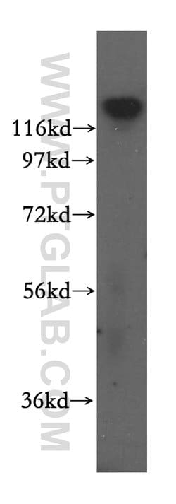 IWS1 Rabbit anti-Human, Mouse, Rat, Polyclonal, Proteintech:Antibodies:Primary