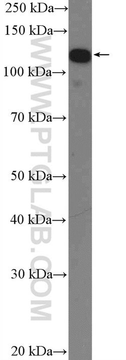 IWS1 Rabbit anti-Human, Mouse, Rat, Polyclonal, Proteintech:Antibodies:Primary