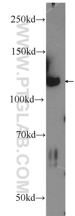 IWS1 Rabbit anti-Human, Mouse, Rat, Polyclonal, Proteintech:Antibodies:Primary