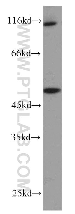 ZNF3 Rabbit anti-Human, Mouse, Rat, Polyclonal, Proteintech 150 &mu;L | Buy Online | Proteintech Group Inc | Fisher Scientific