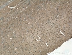 GAP43 Rabbit anti-Human, Mouse, Rat, Polyclonal, Proteintech 150 &mu;L;