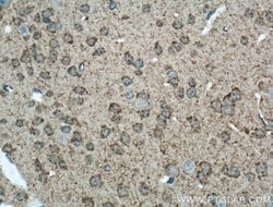 GAP43 Rabbit anti-Human, Mouse, Rat, Polyclonal, Proteintech 150 &mu;L;