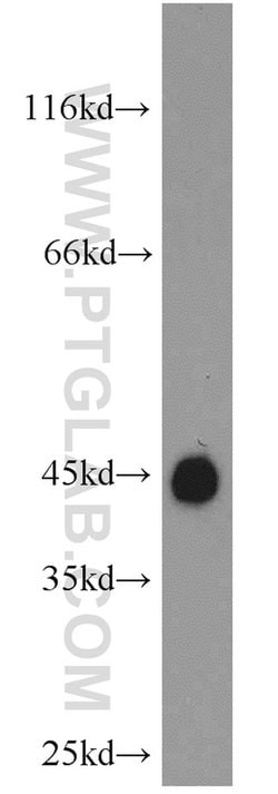 GAP43 Rabbit anti-Human, Mouse, Rat, Polyclonal, Proteintech 150 &mu;L;