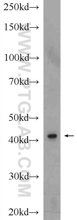 GAP43 Rabbit anti-Human, Mouse, Rat, Polyclonal, Proteintech 150 &mu;L;