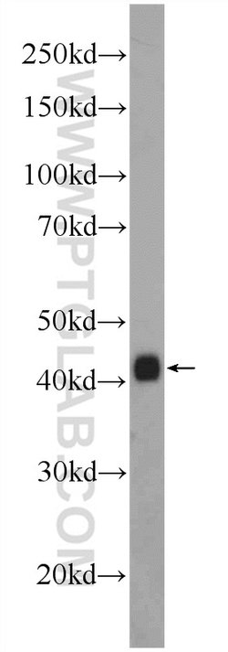 GAP43 Rabbit anti-Human, Mouse, Rat, Polyclonal, Proteintech 150 &mu;L;