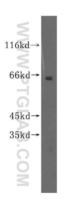 SGOL1 Rabbit anti-Human, Mouse, Rat, Polyclonal, Proteintech 150 &mu;L;