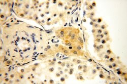 MRPL21 Rabbit anti-Human, Mouse, Rat, Polyclonal, Proteintech 150 &mu;L;