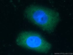 KCNJ3 Rabbit anti-Human, Mouse, Rat, Polyclonal, Proteintech 150 &mu;L | Buy Online | Proteintech Group Inc | Fisher Scientific