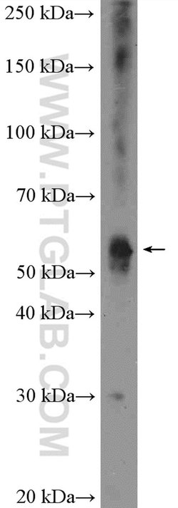 KCNJ3 Rabbit anti-Human, Mouse, Rat, Polyclonal, Proteintech 150 &mu;L | Buy Online | Proteintech Group Inc | Fisher Scientific