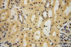 HSDL1 Rabbit anti-Human, Mouse, Rat, Polyclonal, Proteintech 150 &mu;L;