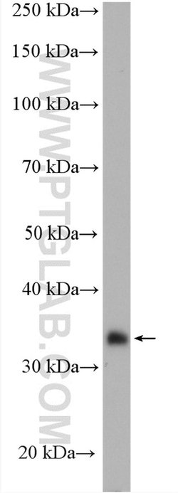 HSDL1 Rabbit anti-Human, Mouse, Rat, Polyclonal, Proteintech 150 &mu;L;