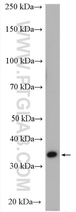 HSDL1 Rabbit anti-Human, Mouse, Rat, Polyclonal, Proteintech 150 &mu;L;
