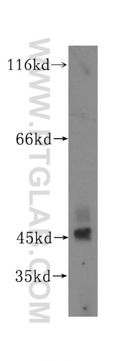 TEX28 Rabbit anti-Human, Polyclonal, Proteintech:Antibodies:Primary Antibodies