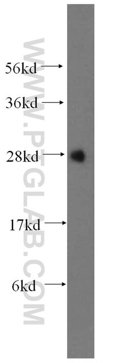METTL7B Rabbit anti-Human, Mouse, Rat, Polyclonal, Proteintech 150 &mu;L;