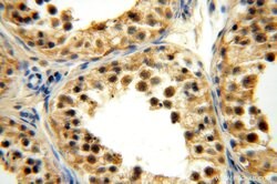 TBC1D23 Rabbit anti-Human, Mouse, Rat, Polyclonal, Proteintech 150 &mu;L;
