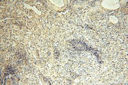 TBC1D23 Rabbit anti-Human, Mouse, Rat, Polyclonal, Proteintech 150 &mu;L;