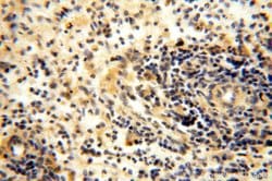 TBC1D23 Rabbit anti-Human, Mouse, Rat, Polyclonal, Proteintech 150 &mu;L;