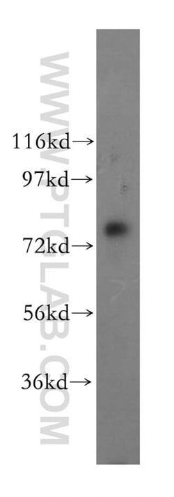 TBC1D23 Rabbit anti-Human, Mouse, Rat, Polyclonal, Proteintech 150 &mu;L;