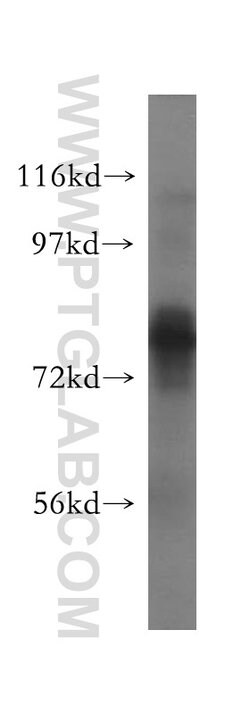 TBC1D23 Rabbit anti-Human, Mouse, Rat, Polyclonal, Proteintech 150 &mu;L;