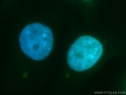 RECQL4 Rabbit anti-Human, Polyclonal, Proteintech 150 &mu;L; Unconjugated:Antibodies,