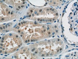 RECQL4 Rabbit anti-Human, Polyclonal, Proteintech 150 &mu;L; Unconjugated:Antibodies,