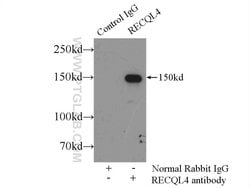 RECQL4 Rabbit anti-Human, Polyclonal, Proteintech 150 &mu;L; Unconjugated:Antibodies,