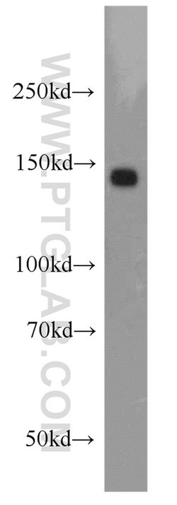 RECQL4 Rabbit anti-Human, Polyclonal, Proteintech 150 &mu;L; Unconjugated:Antibodies,