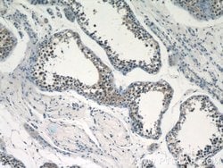 RECQL4 Rabbit anti-Human, Polyclonal, Proteintech 150 &mu;L; Unconjugated:Antibodies,