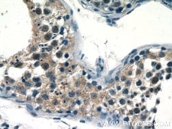 RECQL4 Rabbit anti-Human, Polyclonal, Proteintech 150 &mu;L; Unconjugated:Antibodies,