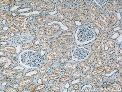 RECQL4 Rabbit anti-Human, Polyclonal, Proteintech 150 &mu;L; Unconjugated:Antibodies,