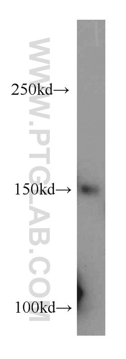RECQL4 Rabbit anti-Human, Polyclonal, Proteintech 150 &mu;L; Unconjugated:Antibodies,