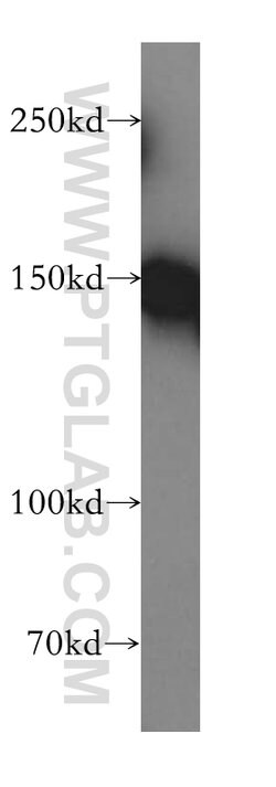 RECQL4 Rabbit anti-Human, Polyclonal, Proteintech 150 &mu;L; Unconjugated:Antibodies,