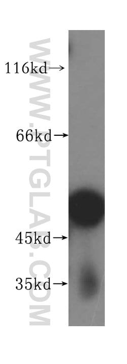 ACTR3B Rabbit anti-Human, Mouse, Rat, Polyclonal, Proteintech 150 &mu;L;
