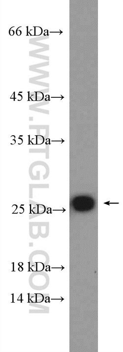 RPL18 Rabbit anti-Human, Mouse, Rat, Polyclonal, Proteintech 150 &mu;L;