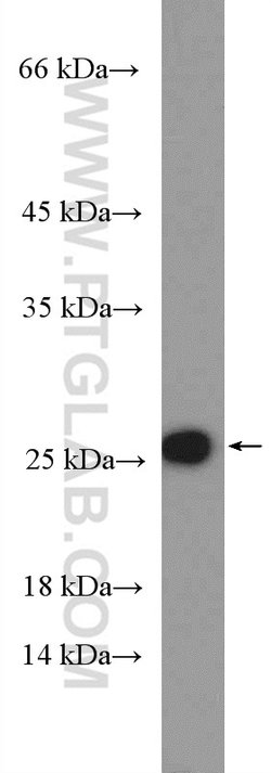 RPL18 Rabbit anti-Human, Mouse, Rat, Polyclonal, Proteintech 150 &mu;L;