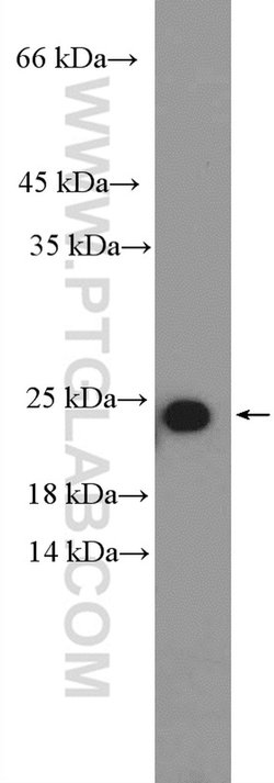 RPL18 Rabbit anti-Human, Mouse, Rat, Polyclonal, Proteintech 150 &mu;L;