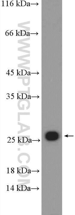 RPL18 Rabbit anti-Human, Mouse, Rat, Polyclonal, Proteintech 150 &mu;L;