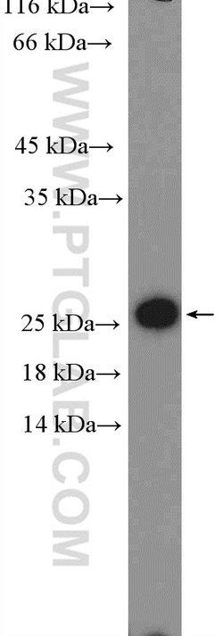RPL18 Rabbit anti-Human, Mouse, Rat, Polyclonal, Proteintech 150 &mu;L;